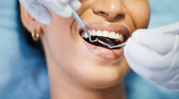 Best Emergency Broken Tooth Repair in South Point, OH