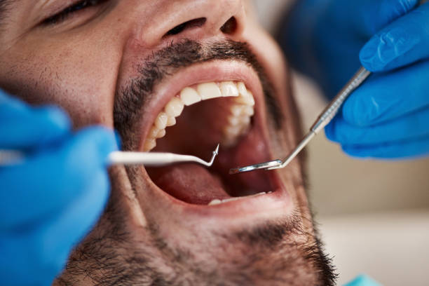 Best Emergency Tooth Extraction in South Point, OH